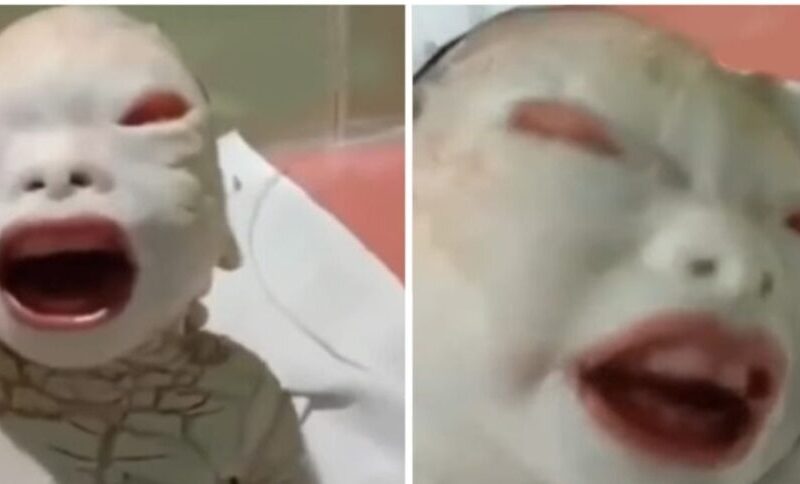 Alien Child Birth News: महिला ने दिया ‘एलियन’ जैसे बच्चे को जन्म, डॉक्टर्स भी रह गए हैरान वायरल वीडियो